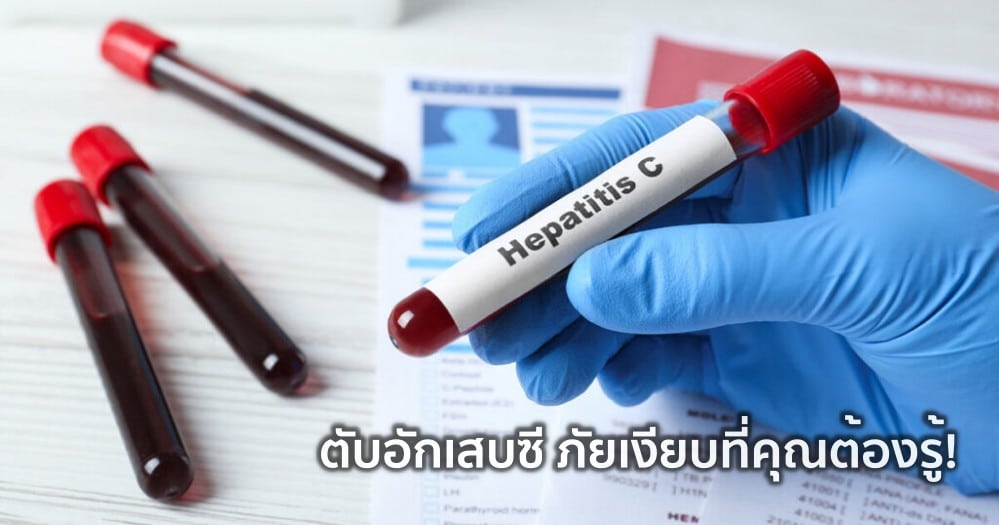 ไวรัสตับอักเสบซี: โรคติดต่อทางเลือด การตรวจ และการรักษาให้หาย